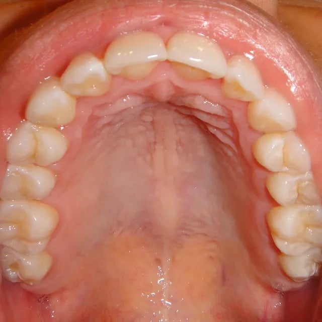 Shelling Orthodontics