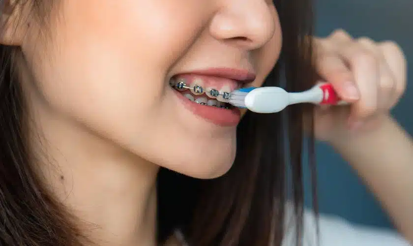 Oral hygiene with braces