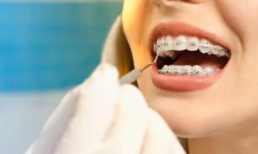 Orthodontist-in-Boca-Raton